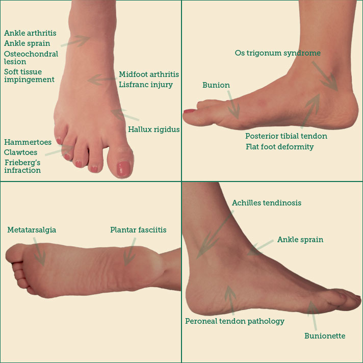 Foot and Ankle Diagnosis interactive map
